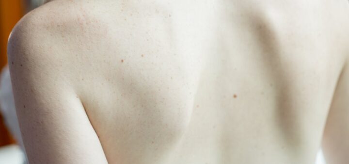 Domowe metody na ból pleców