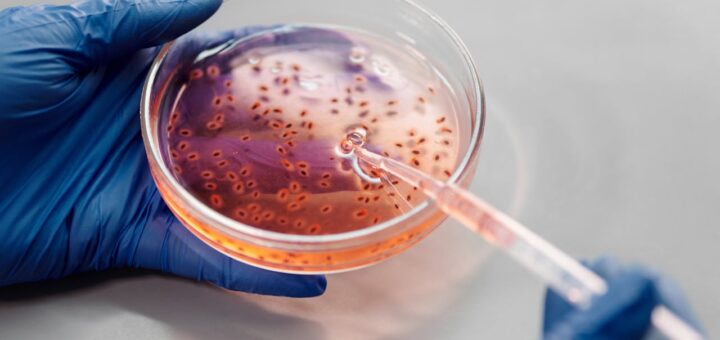 Jakie mogą być bakterie w wodzie