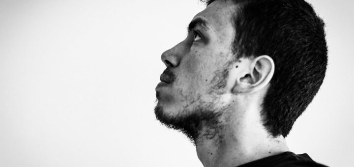 Naturalne metody na poprawę zdrowia skóry głowy